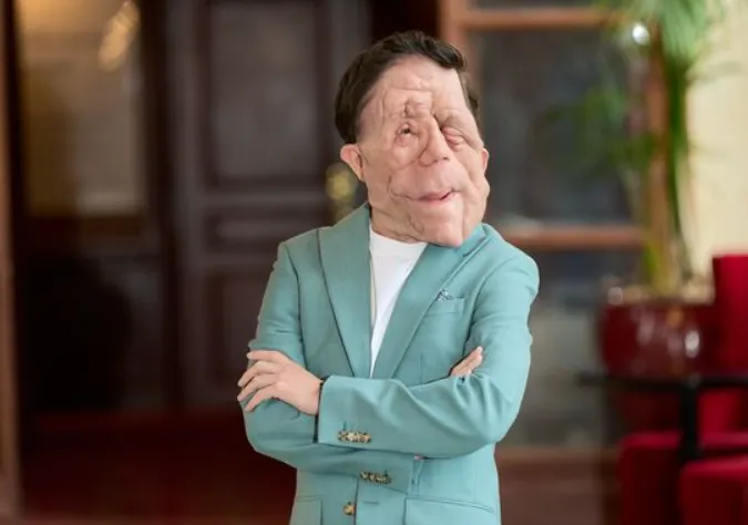 Adam Pearson's Wife Is the British Actor Married Full Bio, Net Worth & Personal Life