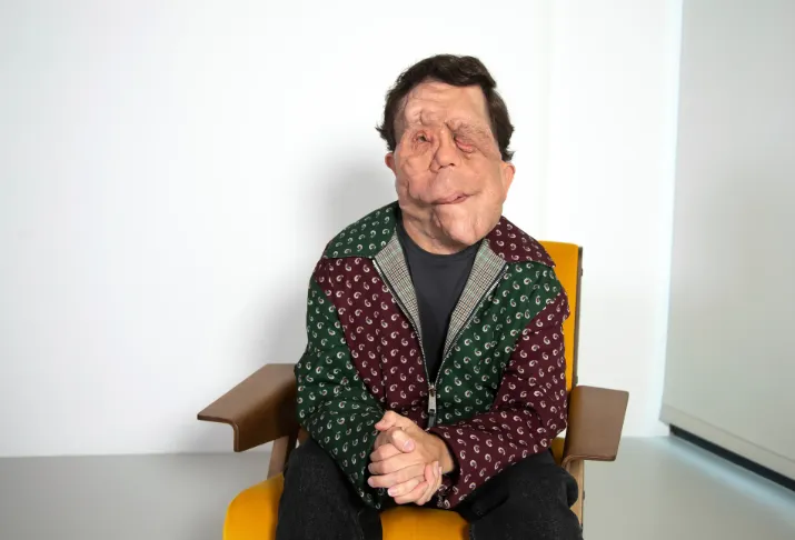 Adam Pearson's Wife Is the British Actor Married Full Bio, Net Worth & Personal Life