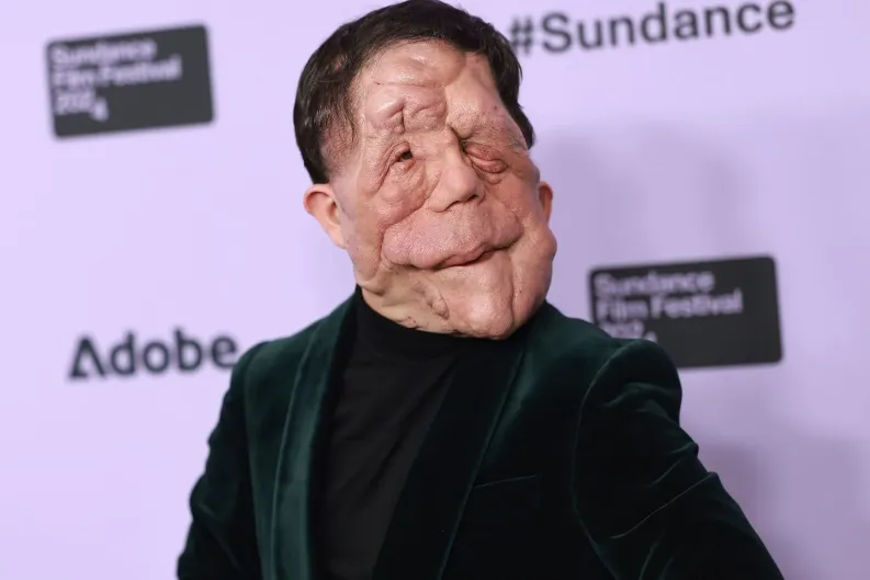 Adam Pearson's Wife Is the British Actor Married Full Bio, Net Worth & Personal Life (4)